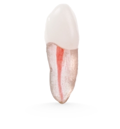 X2 Endo™#11 Incisor (UL3)