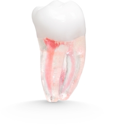 X2 Endo™#31 Molar (LR7)