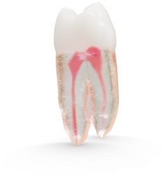 X2 Endo™#05 Pre-Molar (UR4)