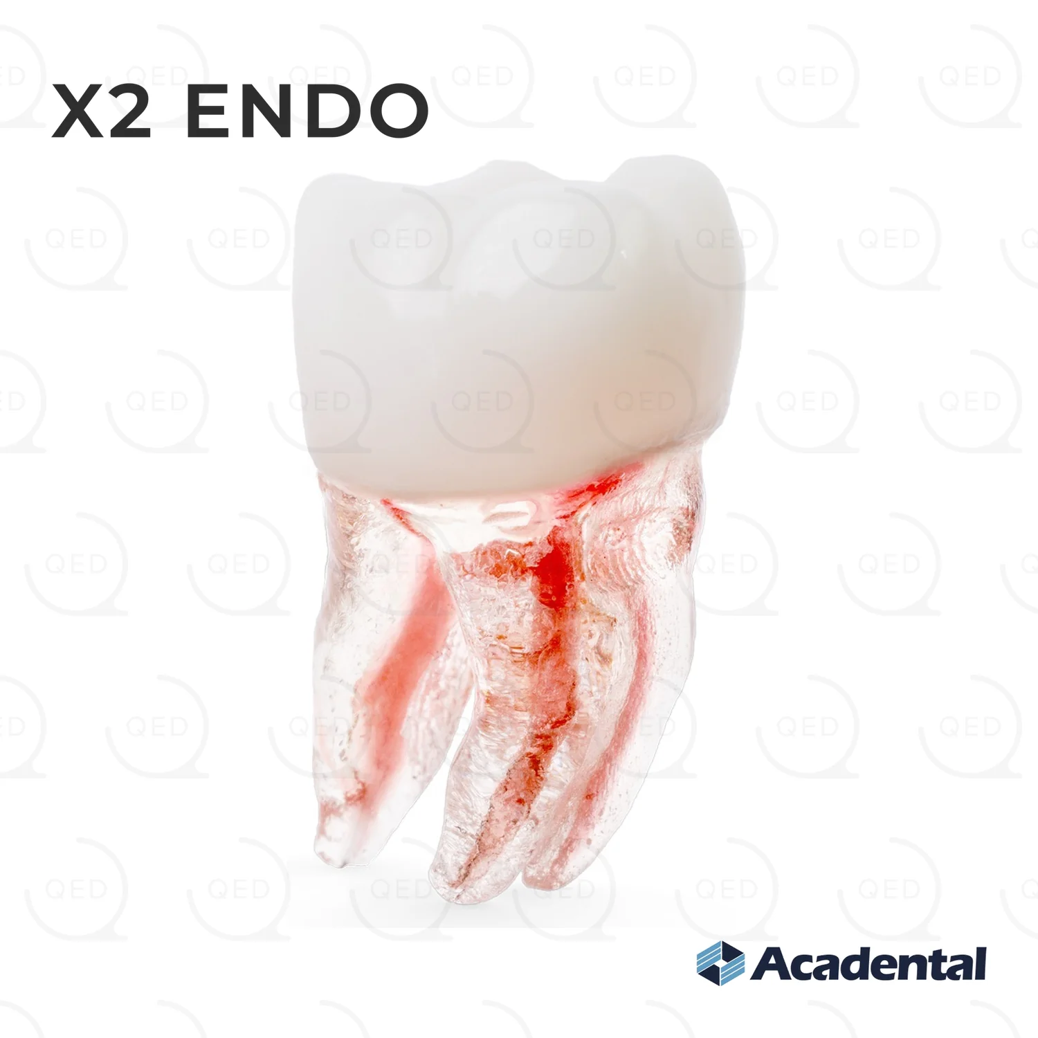X2 Endo™ #30 Molar (LR6)