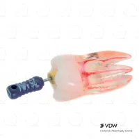 Training Tooth #3 Molar UR6 (5)